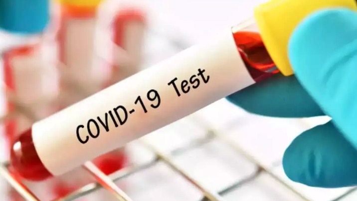 291 new  COVID- 19 cases reported from J&K today; 144 from Jammu and 147 from Kashmir division, total number of cases 119344