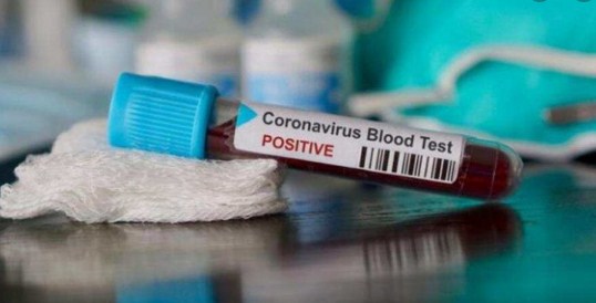 JK reports 132 new positive cases, 3531 recovered so far