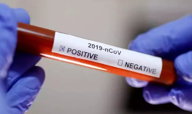 Five girls test positive for covid-19 during RAT drive at GMC PG Hostel