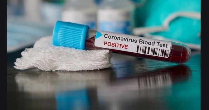 76 new COVID-19 cases reported from J&K today