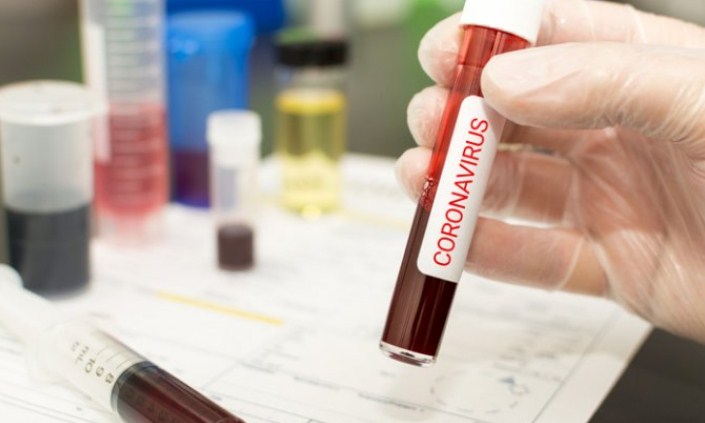 J&K: Son of police personnel tests coronavirus positive in Kupwara; several officials quarantined
