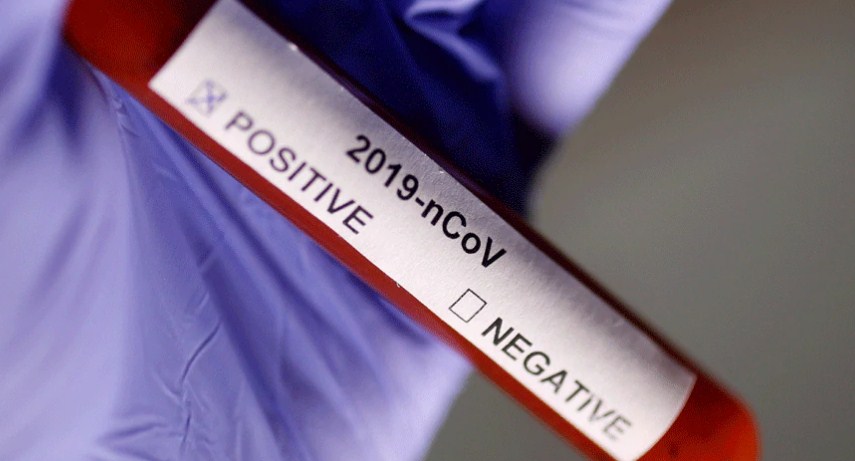 India adds 50,357 new COVID-19 cases, tally crosses 84-lakh mark