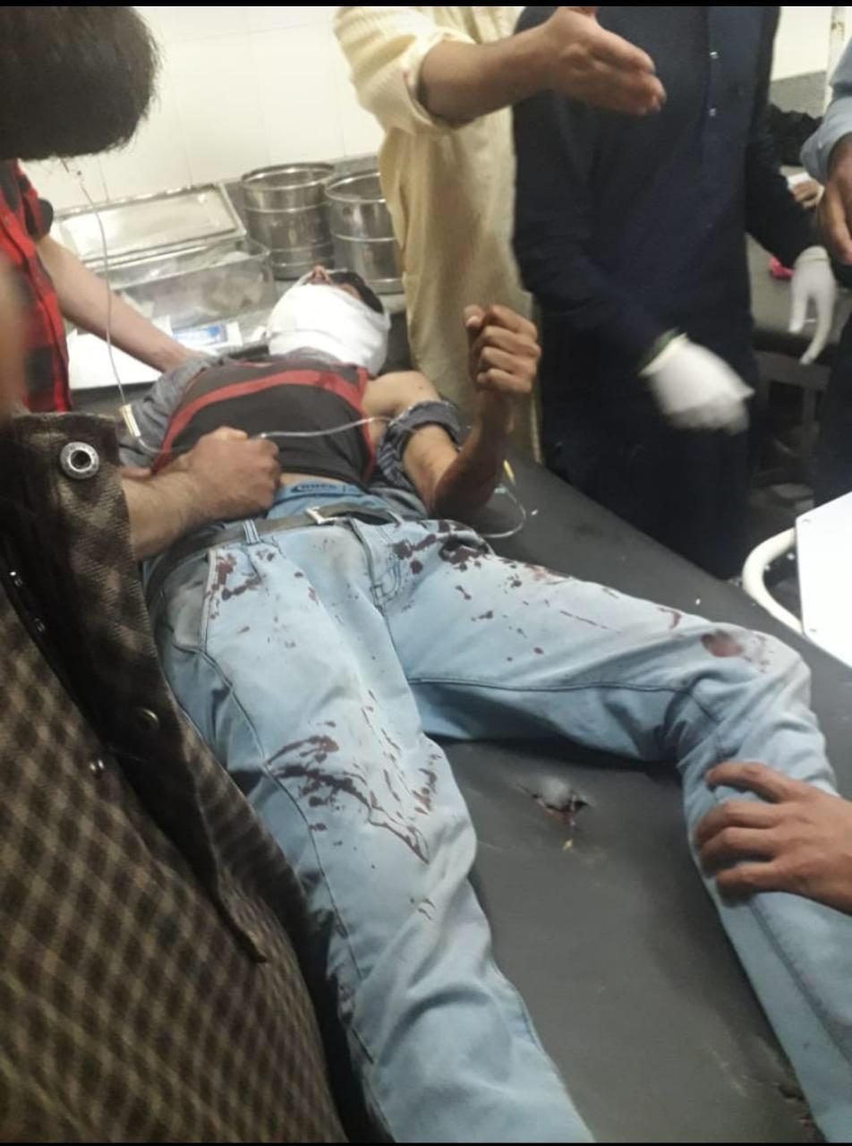 Three recieve bullet injuries during Clashes in Pulwama