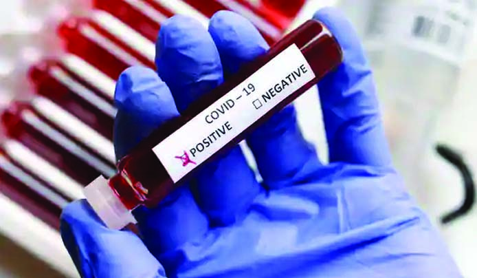 4-year old girl, 12 non-locals among 28 test positive for Covid-19 in Kashmir, J&K Tally surges to 273.