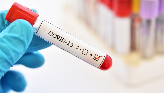 Former DGP of J&K SP vaid along his Wife and Son Tested Positive for Coronavirus