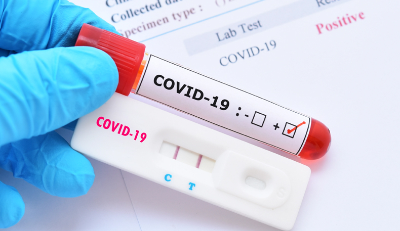 Advisor to LG J&K tests positive for Covid-19