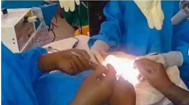 16 kg tumour removed from 20-yr-old woman's abdomen in Bhopal