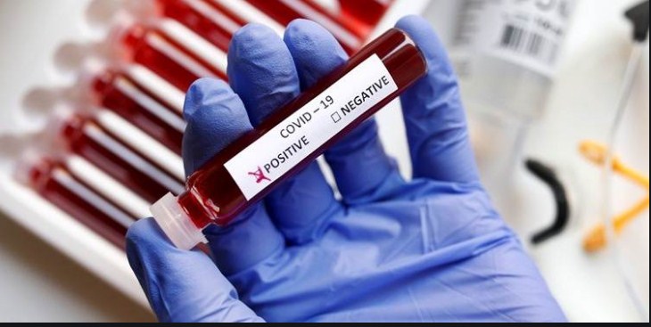 Defence Secy tests positive for COVID-19