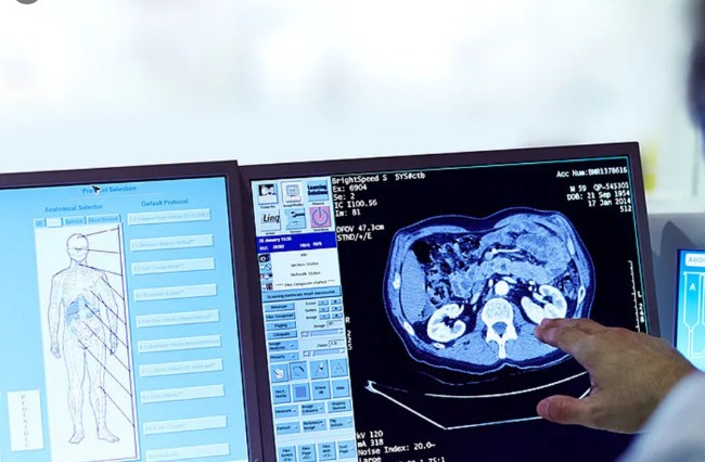 Over 1000 beneficiaries provided services in first week of launch of tele-radiology in JK