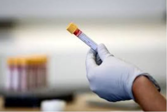 Amid JN.1 scare, India logs 636 new Covid-19 cases, 3 deaths