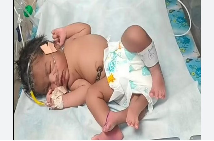 Woman gives birth to baby girl with ‘four’ legs in MP’s Gwalior