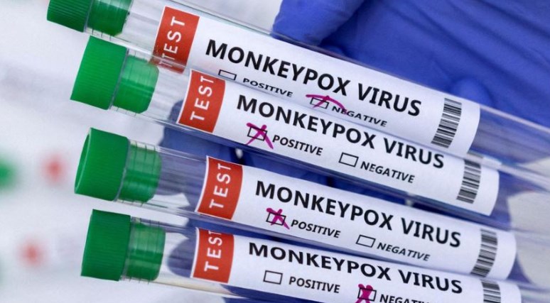 Monkeypox: Kerala confirms India's first death and isolates 20 contacts