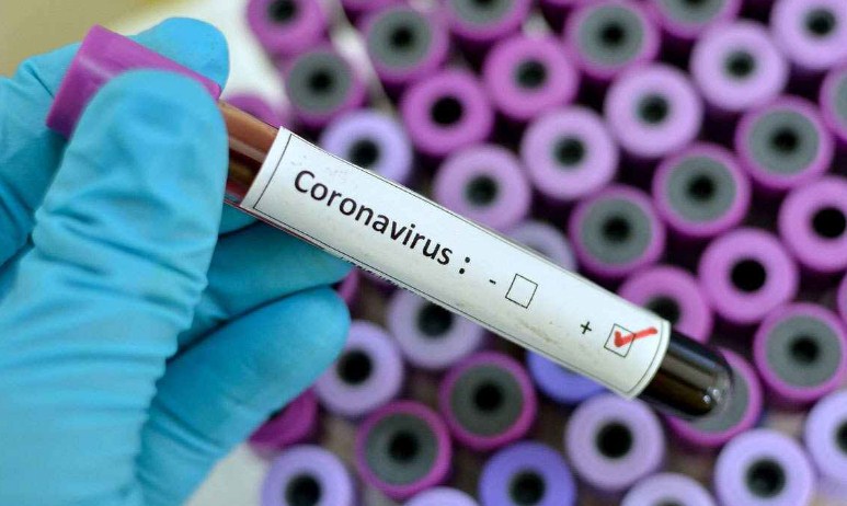 91 new COVID-19 cases reported from Jammu and Kashmir today