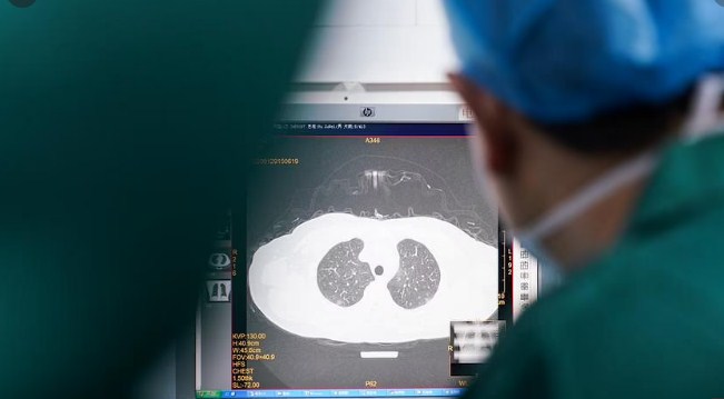 Covid-19 Not Just Lung Disease, Can Also Cause Dangerous Blood Clots: Experts