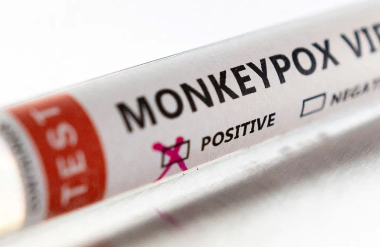 Monkeypox Symptoms, Prevention As India Records 4 Cases