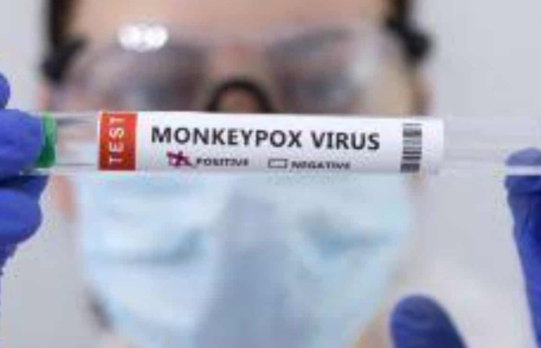 WHO declares monkeypox a global emergency