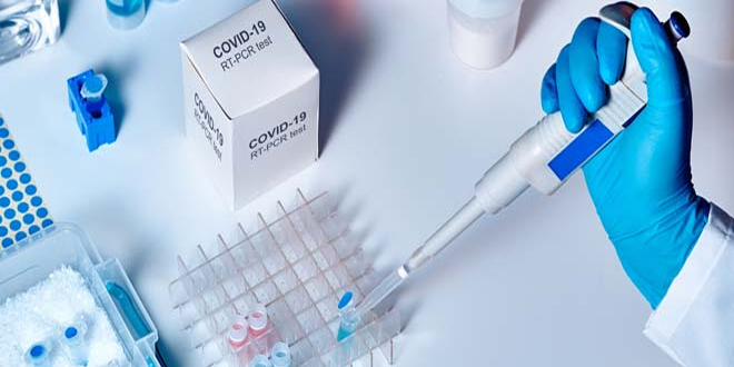Plea in Supreme Court seeks to fix maximum rate for RT-PCR tests