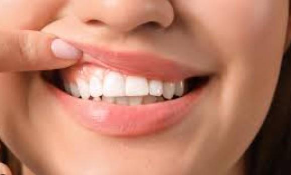 Oral Health: 8 essential dental habits to keep your teeth and gums healthy