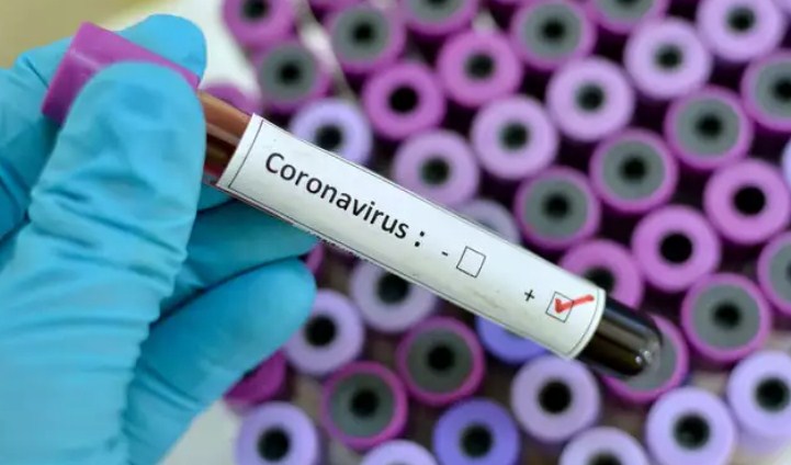 257 new COVID-19 cases reported from J&K today; 144 from Jammu and 113 from Kashmir division, total number of cases 118263